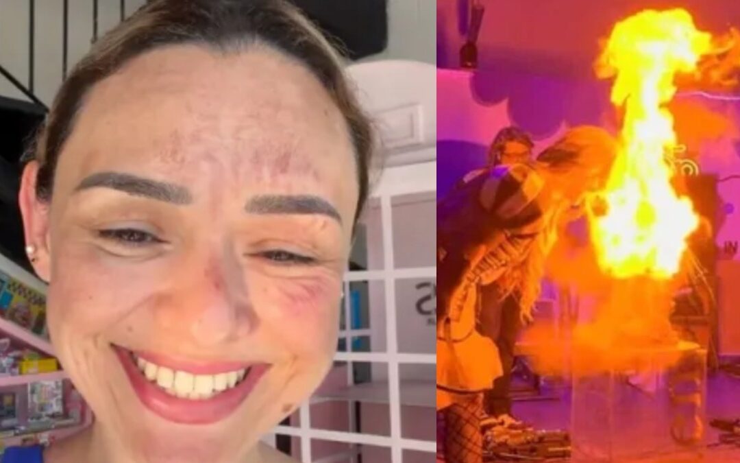 Arlen Hernández, la Influencer de Phoenix, sufre quemaduras en el rostro por un ‘pastel explosivo’